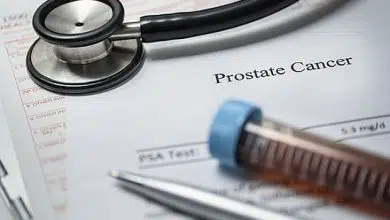 Algunos hombres cuyo cáncer de próstata progresa pueden retrasar el tratamiento de manera segura 8 Algunos hombres cuyo cáncer de próstata progresa pueden retrasar el tratamiento de manera segura