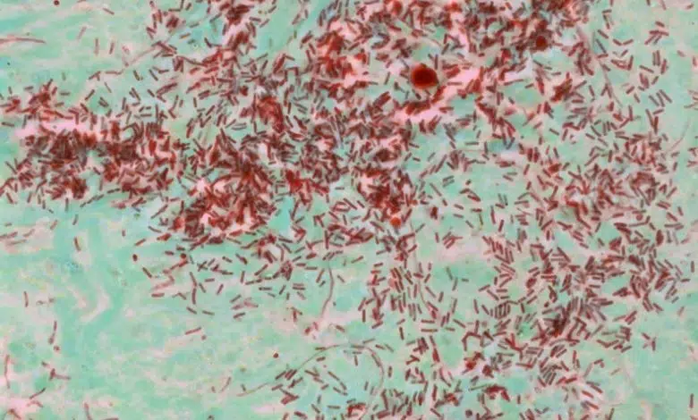 El cerebro tiene un tipo especial de memoria para infecciones pasadas 1 El cerebro tiene un tipo especial de memoria para infecciones pasadas