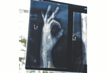 radiology scan of hand doing an okay symbol
