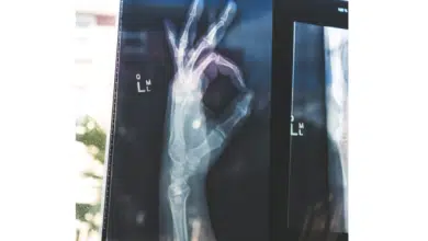 radiology scan of hand doing an okay symbol
