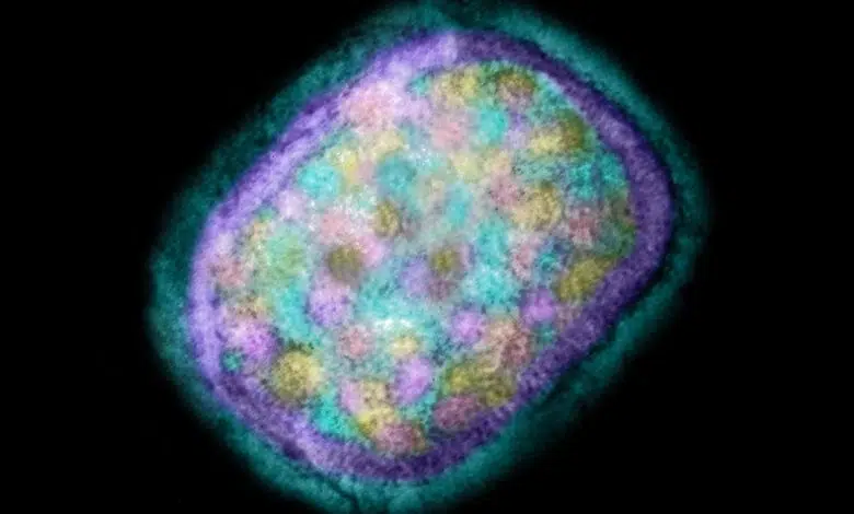 Lo que sabemos sobre el aumento de los casos de viruela del mono en todo el mundo 1 Lo que sabemos sobre el aumento de los casos de viruela del mono en todo el mundo