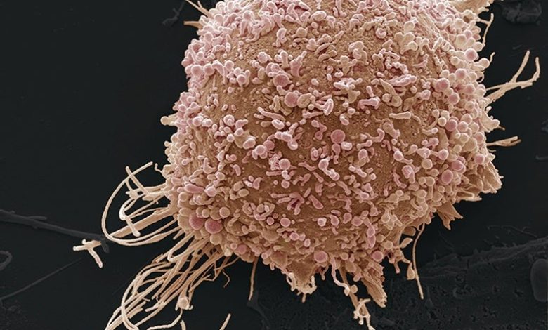 Aplicación basada en inteligencia artificial podría detectar cáncer de cuello uterino 1 Aplicación basada en inteligencia artificial podría detectar cáncer de cuello uterino