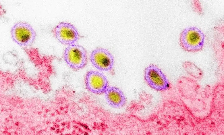Descubrimiento de nueva variante de VIH advierte sobre pandemia de COVID-19 1 Descubrimiento de nueva variante de VIH advierte sobre pandemia de COVID-19