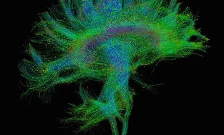 En qué se diferencia el cerebro humano: tiene mucho que ver con las conexiones 1 En qué se diferencia el cerebro humano: tiene mucho que ver con las conexiones