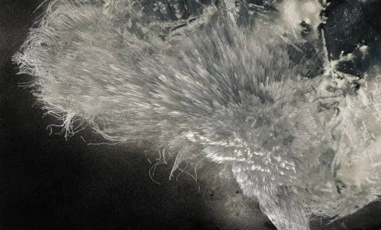 Inspirada en una enfermedad crónica, creó un arte premiado sobre el cerebro 1 Inspirada en una enfermedad crónica, creó un arte premiado sobre el cerebro