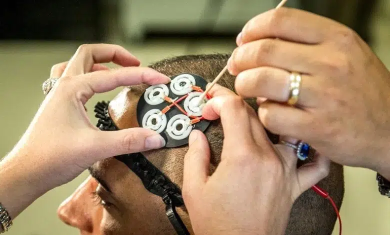 La estimulación cerebral eléctrica podría aliviar los comportamientos obsesivo-compulsivos 1 La estimulación cerebral eléctrica podría aliviar los comportamientos obsesivo-compulsivos