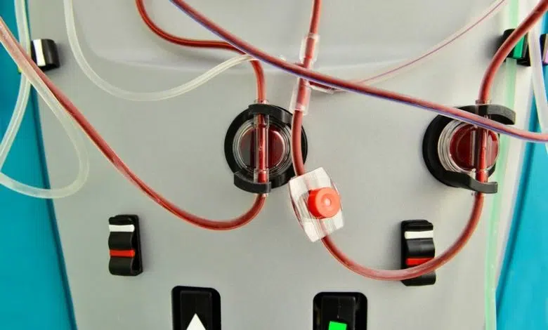 La inteligencia artificial puede predecir la insuficiencia renal con días de antelación 1 La inteligencia artificial puede predecir la insuficiencia renal con días de antelación