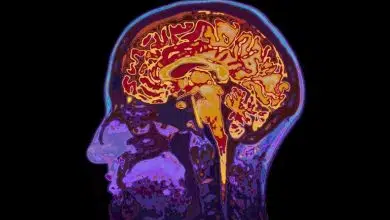 Los recuerdos olvidados de eventos traumáticos obtienen cierto respaldo de los estudios de imágenes cerebrales