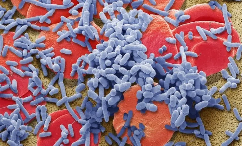 Algoritmo para detectar sepsis reduce las muertes en casi un 20% 1 Algoritmo para detectar sepsis reduce las muertes en casi un 20%