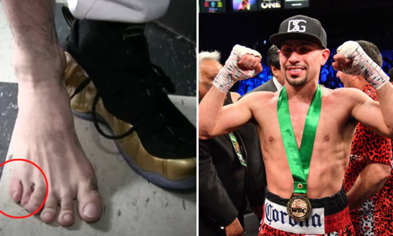El excampeón mundial de boxeo Danny García tiene 11 dedos en los pies, dice que le da una ventaja en el ring 1 El excampeón mundial de boxeo Danny García tiene 11 dedos en los pies, dice que le da una ventaja en el ring