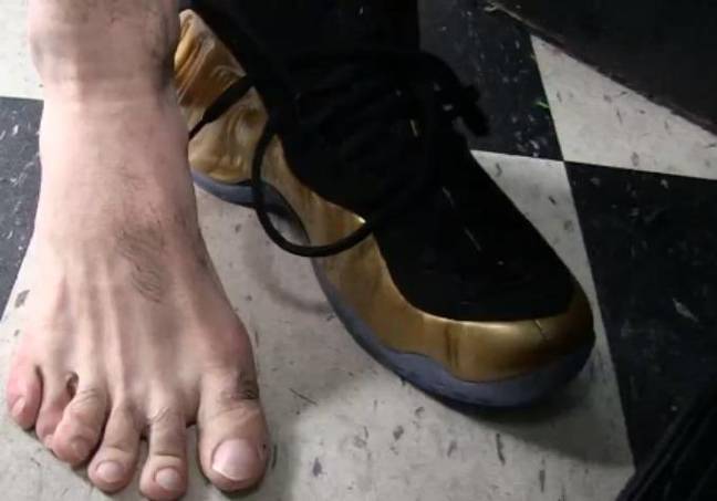 El excampeón mundial de boxeo Danny García tiene 11 dedos en los pies, dice que le da una ventaja en el ring 2 Imagen: Deportes TMZ