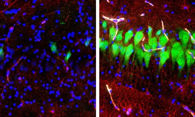 El sistema de recuperación cerebral explora el borroso reino entre la vida y la muerte 1 El sistema de recuperación cerebral explora el borroso reino entre la vida y la muerte