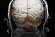 Enorme estudio cerebral revela red genética 'oculta' vinculada a enfermedades mentales