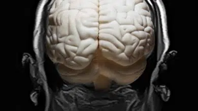Enorme estudio cerebral revela red genética 'oculta' vinculada a enfermedades mentales