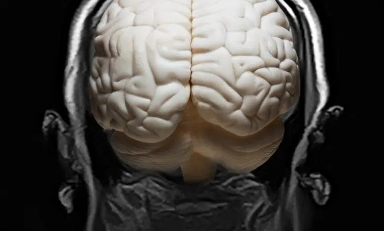 Enorme estudio cerebral revela red genética 'oculta' vinculada a enfermedades mentales 1 Enorme estudio cerebral revela red genética 'oculta' vinculada a enfermedades mentales