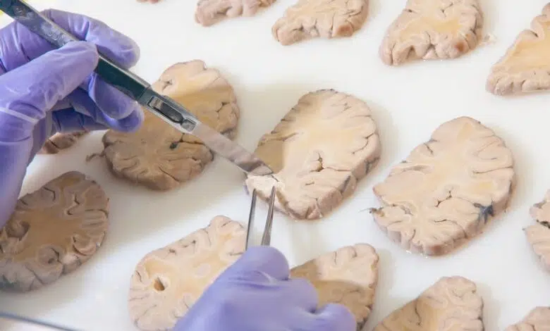 Los científicos se propusieron construir la lista de partes del cerebro 1 Los científicos se propusieron construir la lista de partes del cerebro