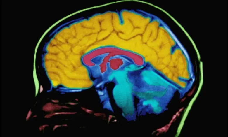 Los efectos cerebrales de la tecnología: es complicado 1 Los efectos cerebrales de la tecnología: es complicado