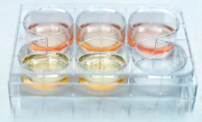 Los 'mini-cerebros' creados en laboratorio ahora pueden imitar la actividad neuronal en bebés prematuros 1 Los 'mini-cerebros' creados en laboratorio ahora pueden imitar la actividad neuronal en bebés prematuros