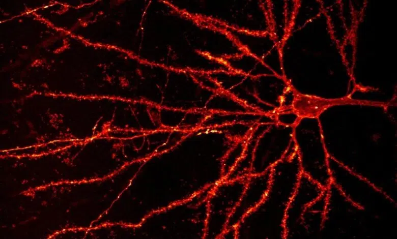 ¿Qué hace que las células del cerebro humano sean diferentes? 1 ¿Qué hace que las células del cerebro humano sean diferentes?
