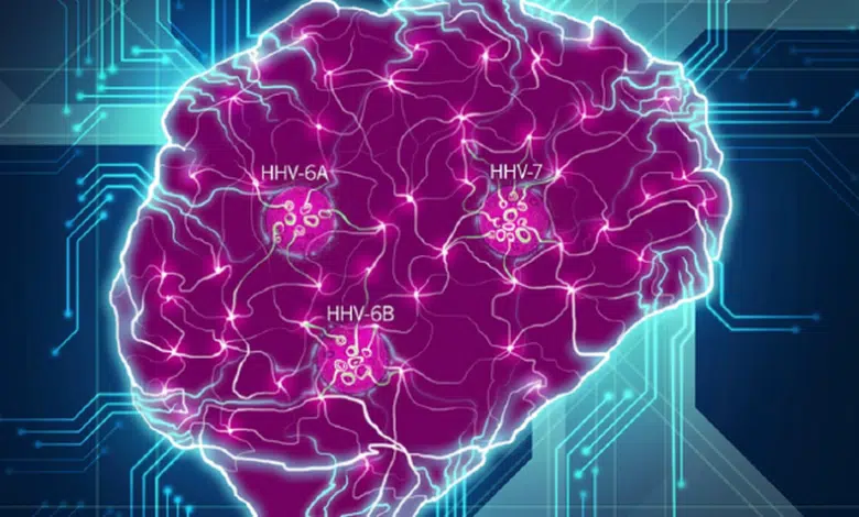 Evidencia más fuerte de que los virus juegan un papel en el Alzheimer 1 Evidencia más fuerte de que los virus juegan un papel en el Alzheimer