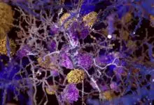 La investigación del Alzheimer genera un nuevo debate sobre la hipótesis del amiloide