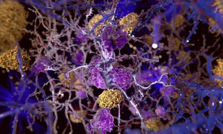 La investigación del Alzheimer genera un nuevo debate sobre la hipótesis del amiloide 1 La investigación del Alzheimer genera un nuevo debate sobre la hipótesis del amiloide