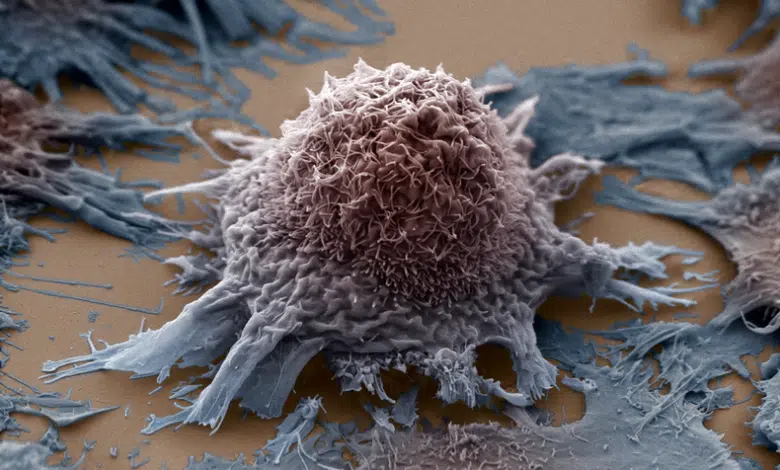 ¿Puede la estimulación cerebral retardar el cáncer? 1 ¿Puede la estimulación cerebral retardar el cáncer?