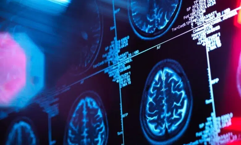 Cerebros humanos en miniatura crecen durante meses después de ser implantados en cráneos de ratones 1 Cerebros humanos en miniatura crecen durante meses después de ser implantados en cráneos de ratones