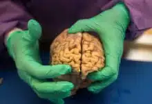 Evidencia impactante que vincula el fútbol con enfermedades cerebrales llama a más investigación