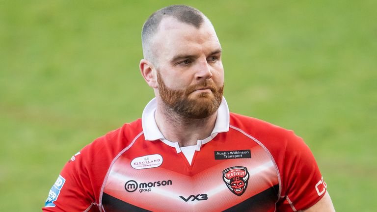 Conmociones cerebrales en la liga de rugby: las experiencias de James Graham, Steve Ward, Tyrone McCarthy, Greg Burke y Tom Johnstone | Noticias de la liga de rugby 4 Greg Burke habla sobre su experiencia con la conmoción cerebral