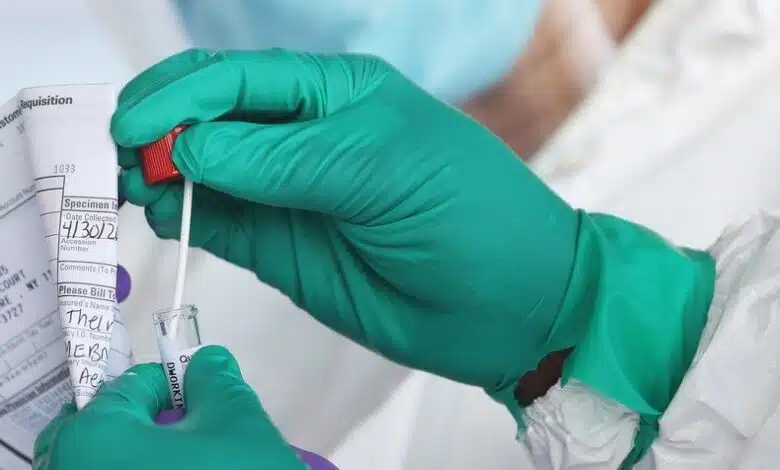 Por qué Estados Unidos tiene una crisis de datos por el coronavirus 1 Por qué Estados Unidos tiene una crisis de datos por el coronavirus