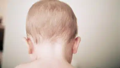 ¿El bebé duele?Los escáneres cerebrales pueden decir 8 ¿El bebé duele?Los escáneres cerebrales pueden decir