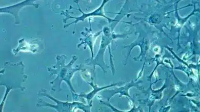 Terapia celular 2.0: Reprogramación de las propias células del cerebro para tratar la enfermedad de Parkinson