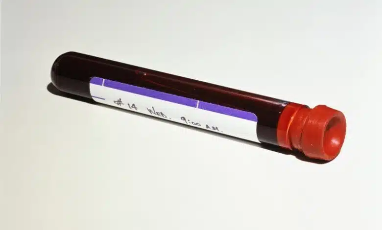 Un análisis de sangre experimental puede detectar el cáncer hasta cuatro años antes de que aparezcan los síntomas 1 Un análisis de sangre experimental puede detectar el cáncer hasta cuatro años antes de que aparezcan los síntomas