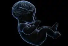 El tratamiento experimental tiene como objetivo prevenir el daño cerebral en los bebés