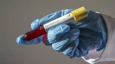 Por qué la historia recuerda a las personas que tengan cuidado con las pruebas de inmunidad al coronavirus