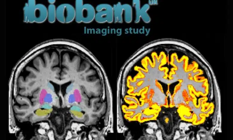 Un proyecto de mapeo cerebral a gran escala en el Reino Unido publica los primeros resultados