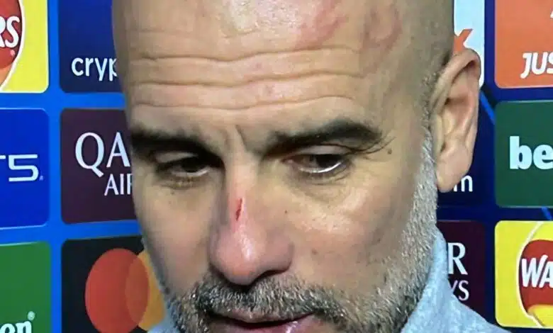 "Quiero causar daño" -Pep Guardiola aparece frente a los medios, con rastros en la cabeza 1 "Quiero causar daño" -Pep Guardiola aparece frente a los medios, con rastros en la cabeza