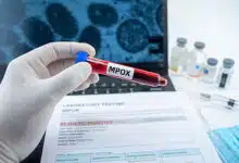 MPOX está de vuelta: Conocer y hacer 4 MPOX está de vuelta: Conocer y hacer