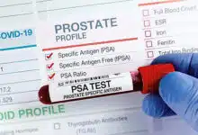 ¿Cuáles son los síntomas del cáncer de próstata? 12 ¿Cuáles son los síntomas del cáncer de próstata?