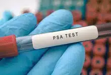 ¿Qué es la prueba de PSA y cómo se utiliza? 12 ¿Qué es la prueba de PSA y cómo se utiliza?