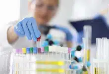 ¿Cómo se detecta y trata el cáncer de próstata metastásico en hombres mayores de 70 años? 4 ¿Cómo se detecta y trata el cáncer de próstata metastásico en hombres mayores de 70 años?